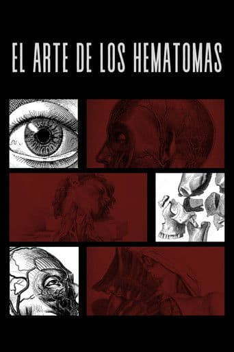 El Arte De Los Hematomas