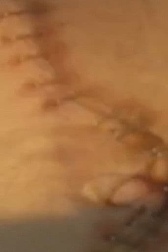 Suite: Double Nephrectomy